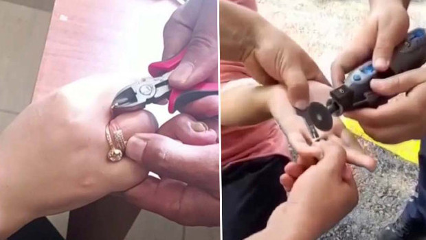 Hatay'da itfaiye ekipleri parmaklarına sıkışan yüzükleri özel aparatlarla çıkardı