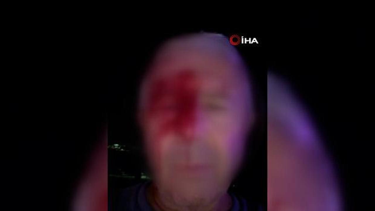 Haber yaparken saldırıya uğrayan muhabir yaralandı
