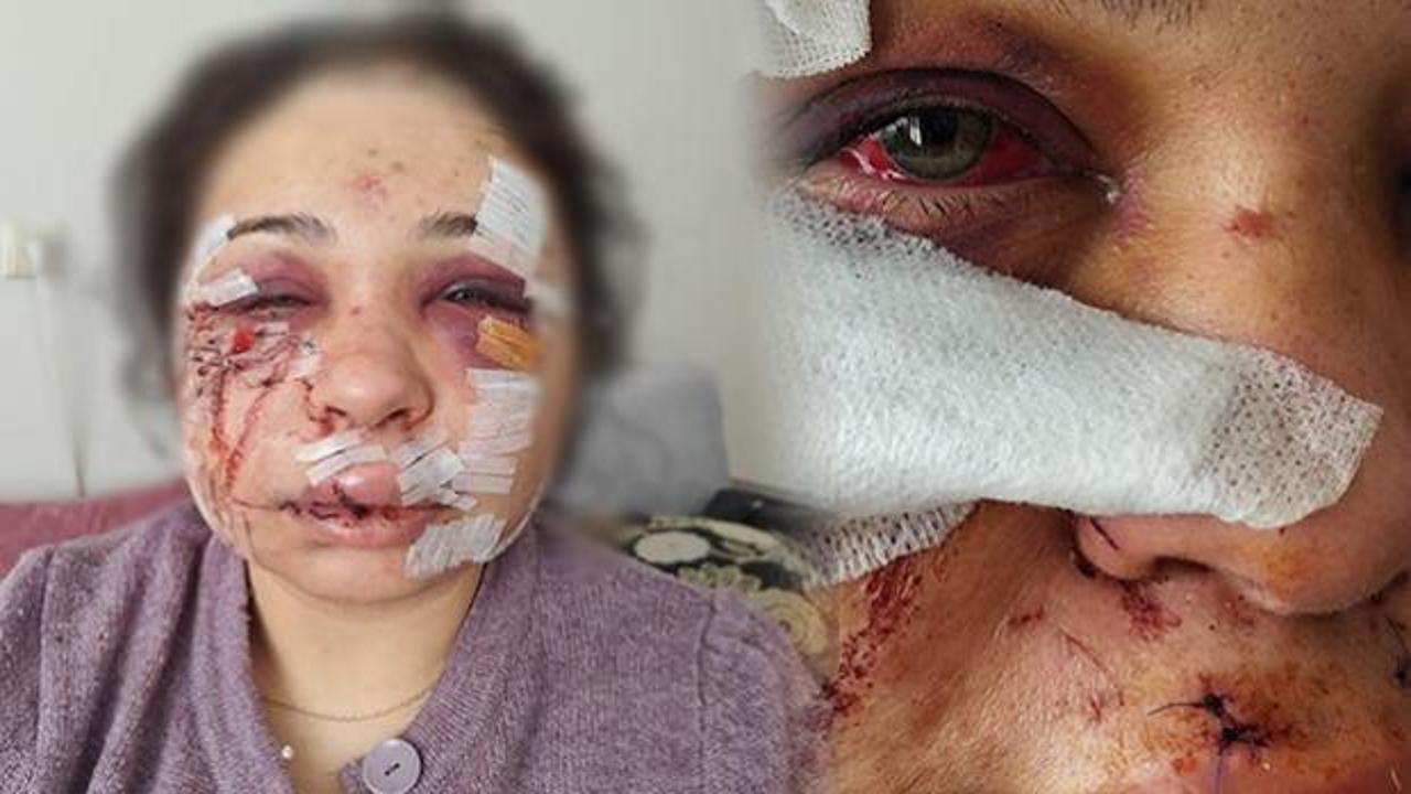 Ankara'da eşini darbeden polis memuruna 'haksız tahrik' indirimi: 7,5 yıl ceza 4 yıl 2 aya düşürüldü