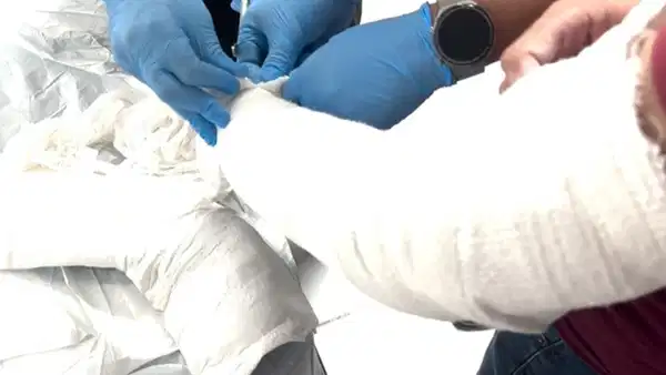 Batman'da Alçılı Kolunda Uyuşturucu Taşıyan Şüpheli Tutuklandı