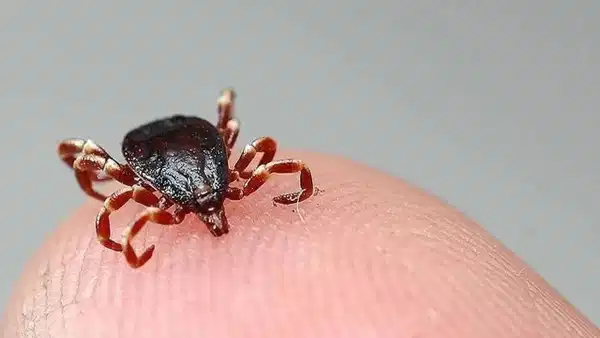 Çorum'da KKKA şüphesiyle tedavi gören kadın hayatını kaybetti