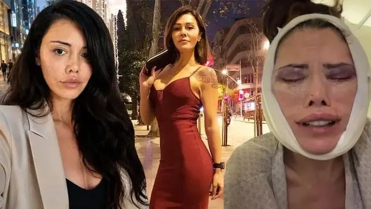 Yüz nakliyle yeni bir hayata başlayan Didem Ceran, çevresinden gelen şikayetlerle sarsıldı: 'Neden ben?'