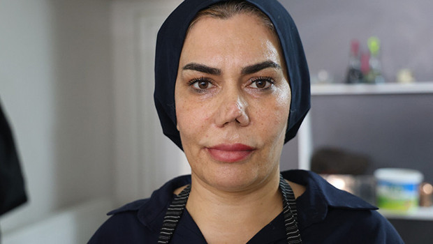 Burnunu düzeltmek isterken 4 ameliyatla hayatı kararan kadın doktora dava açtı