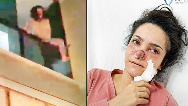 Eşinin burnunu koparan kadın: İmran Güler yaşadıklarını anlattı