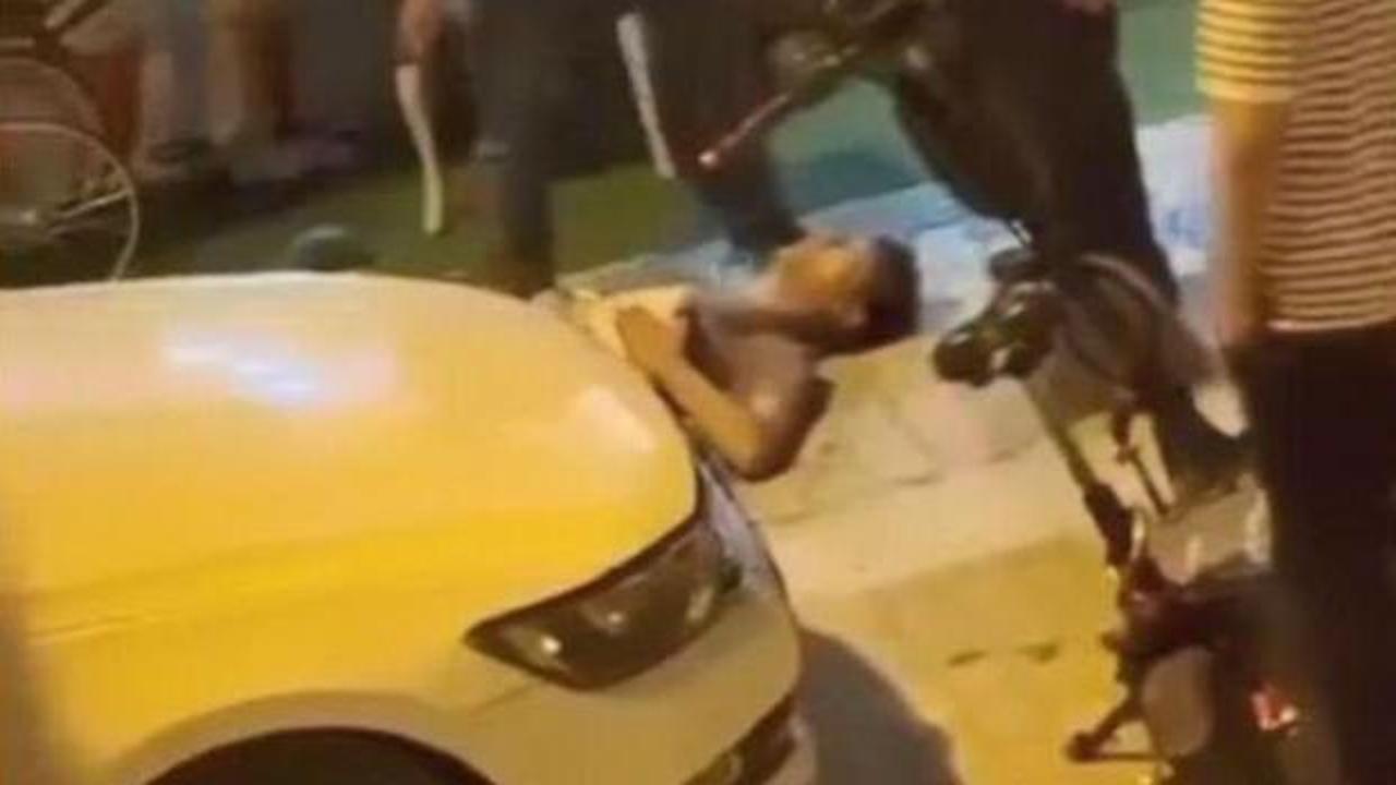 Hamile eşine tatlı almaya giden adam 6 yerinden bıçaklandı: Bebek sezaryenle alındı