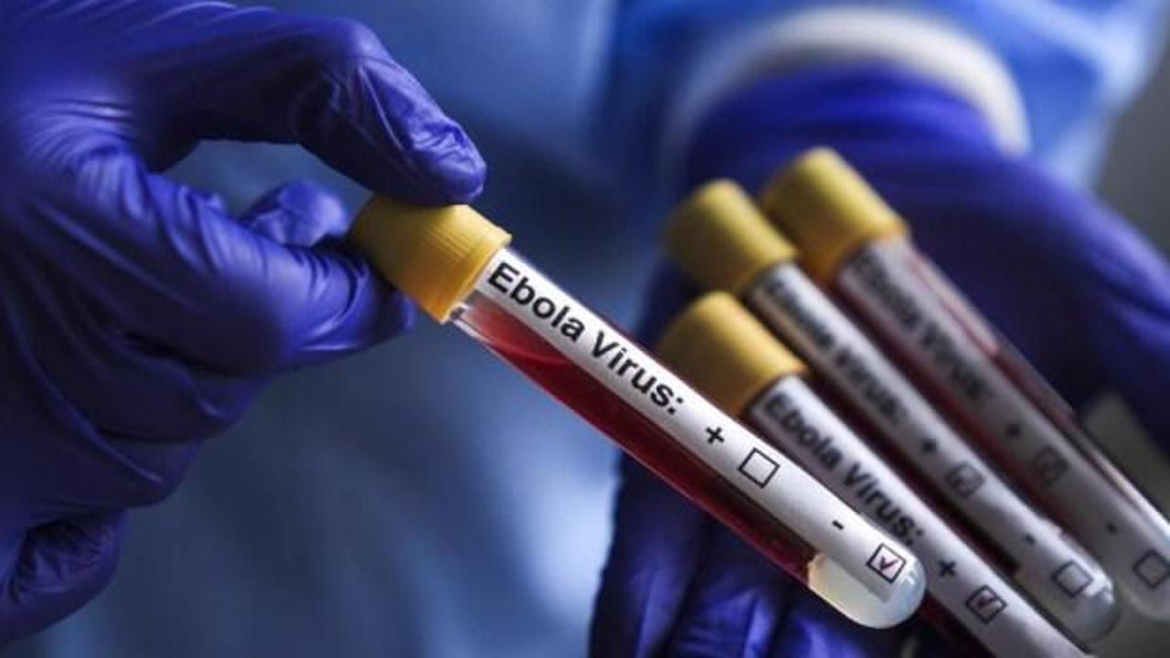 Oxford'un yeni Ebola aşısı insanlı denemelerde: İlk doz İngiliz gönüllüye yapıldı