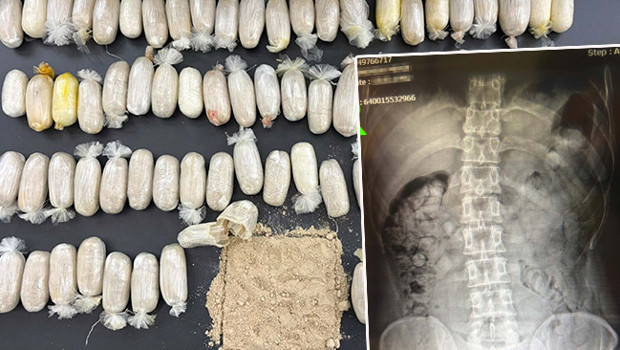 Uşak'ta şüpheli araç durduruldu: 2 İranlının midesinden 605 gram eroin çıktı