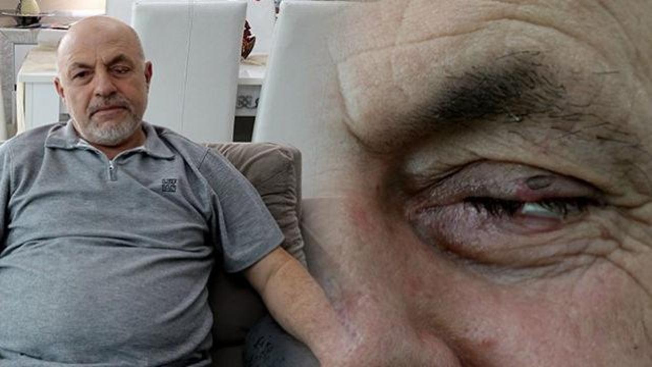 Trabzon'da gözlükten kurtulmak isterken sol gözünü kaybetti: 'İhmal var' iddiası