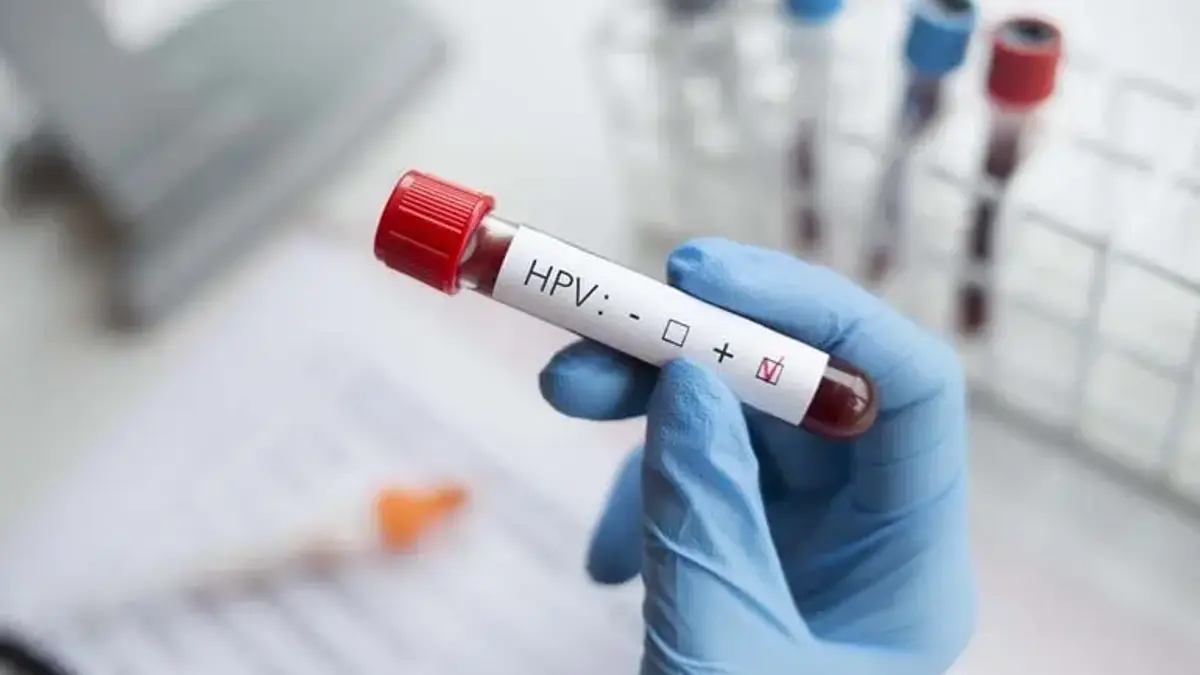 Uzmanı açıkladı: ‘HPV pozitifliği doğrudan kanser anlamına gelmez’